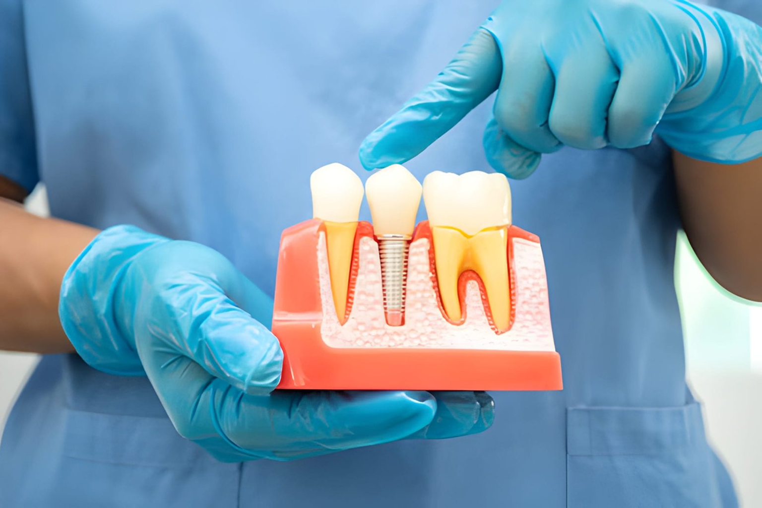 dental Implant treatment