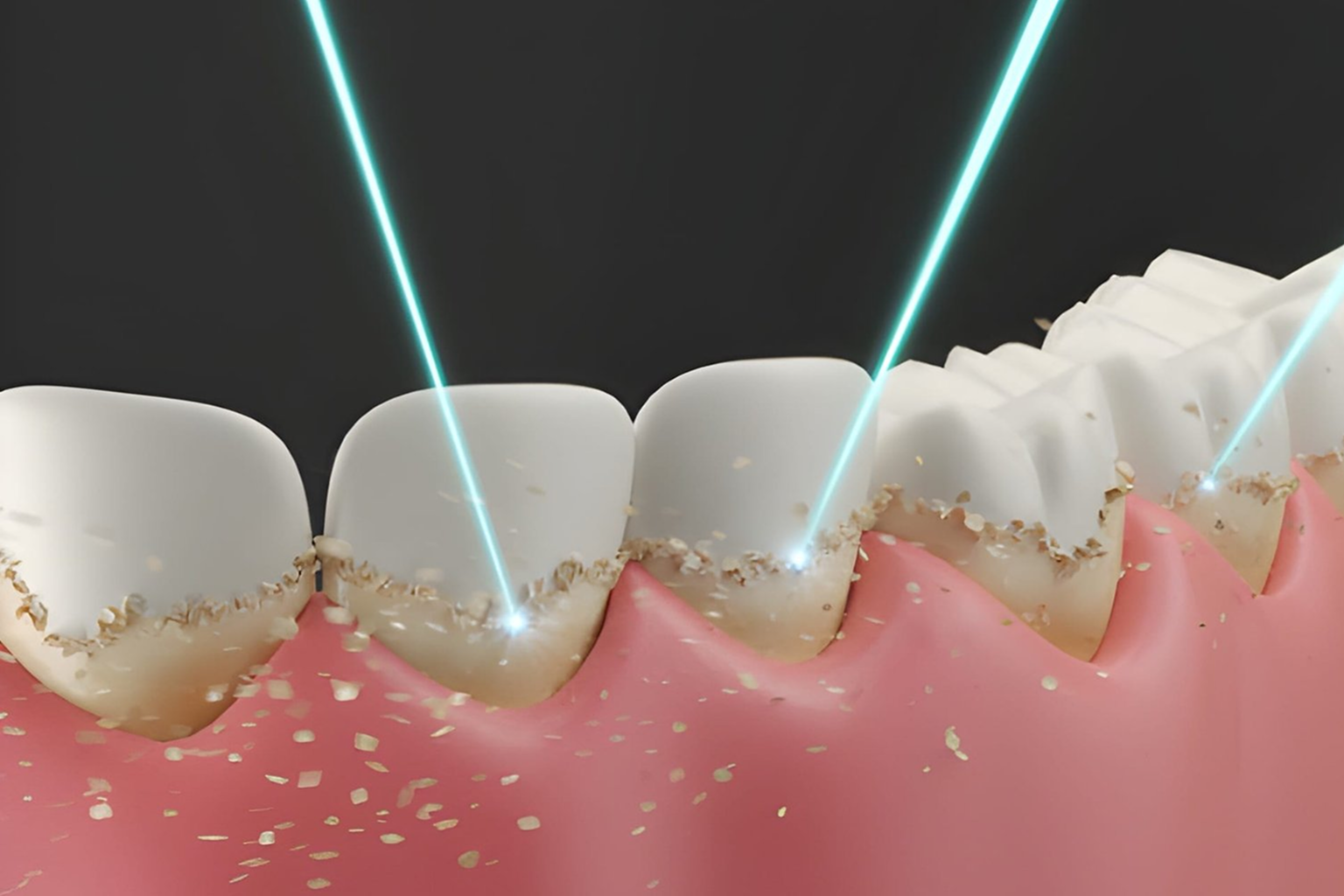 laser dentistry treatment